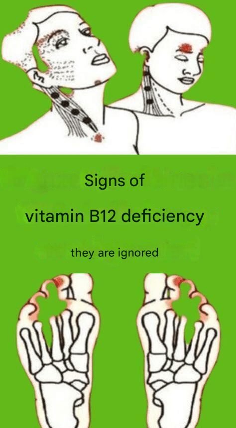 Signs of vitamin B12 deficiency are ignored