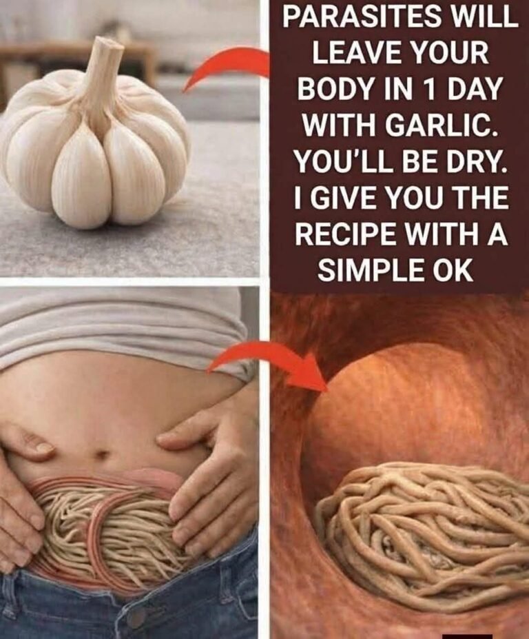 Garlic eliminates parasites in just 1 day? What you really should know before trying it